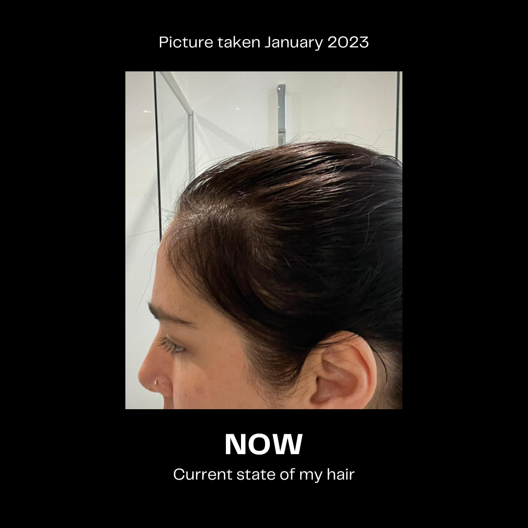 Ever Elixir Hair Oil